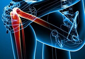 knee pain with arthritis and arthrosis