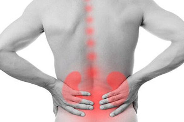 Kidney pathologies can provoke the appearance of lower back pain