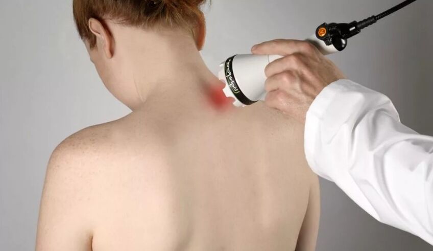 Physiotherapeutic method of treating cervical osteochondrosis