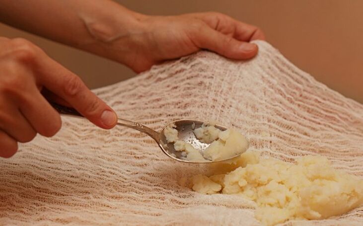 Preparation of a compress from potatoes