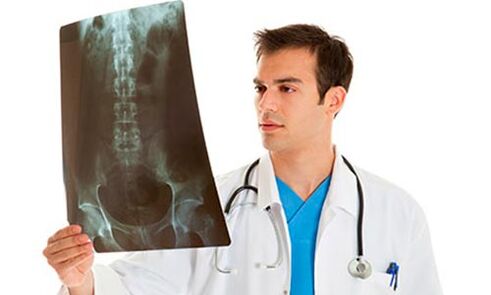 doctor looking at x-ray to diagnose low back pain